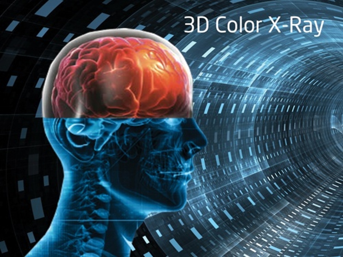 Will 3D Color X-Ray Revolutionize Cancer Treatment?